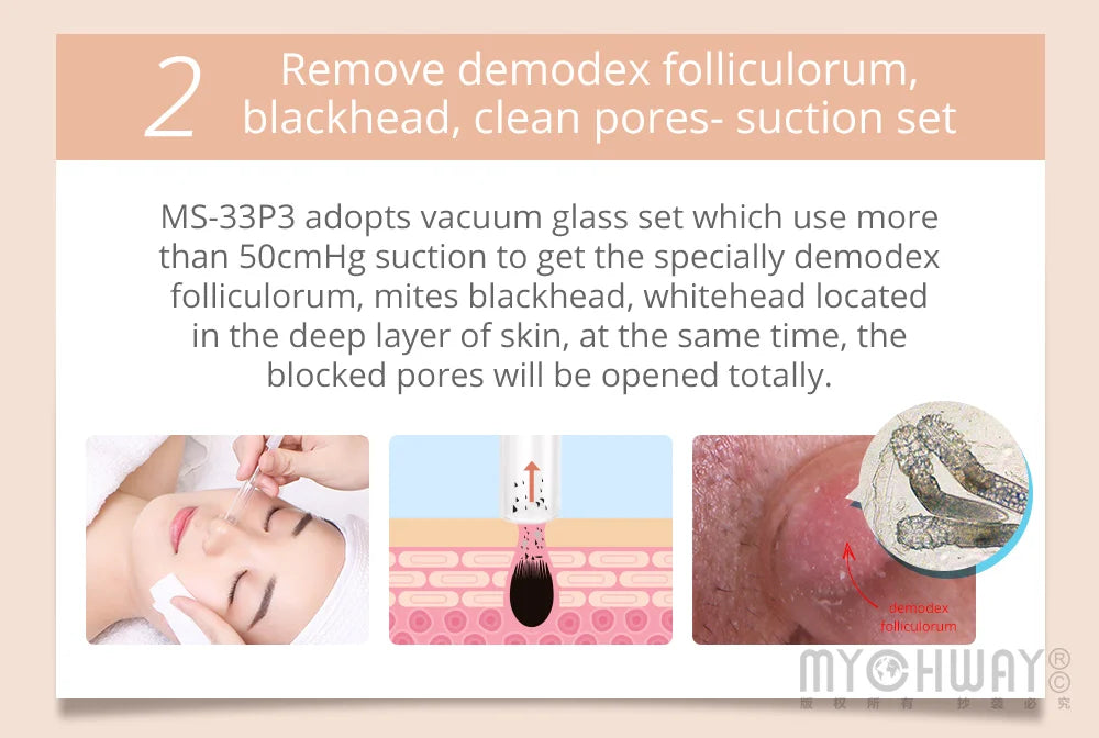3 in 1 Ultrasound Dermabrasion Device